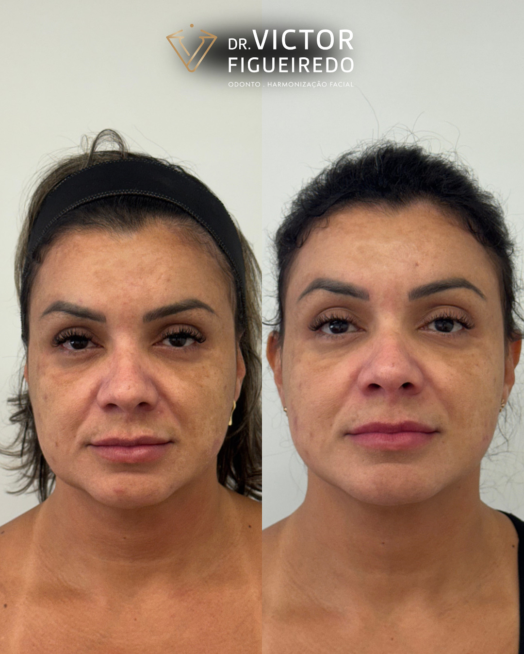 Sem nome (Post para Instagram (4:5)) - 1